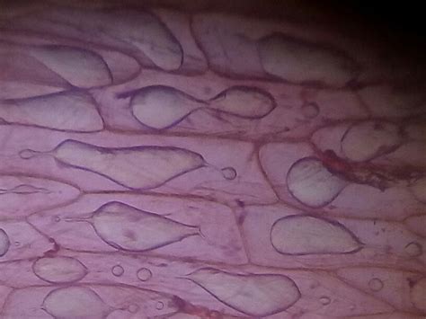 Plasmolysis in onion cell | In this moment