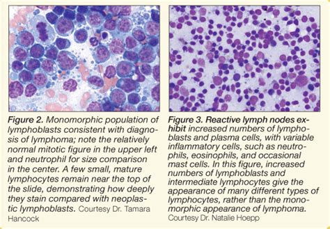 Lymph Node Cytology: What Should & Should Not Be There