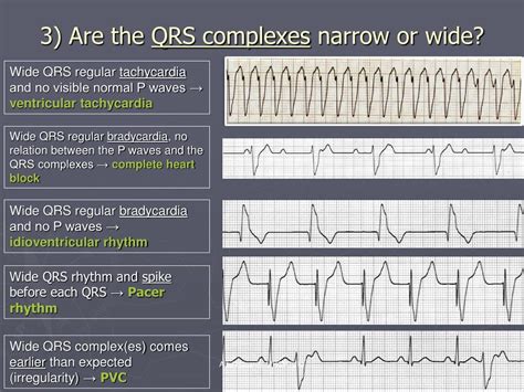 Ppt Adel Hasanin Mrcp Uk Ms Cardiology Powerpoint | Free Nude Porn Photos