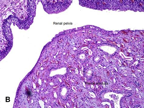 American Urological Association - Renal Pelvis and Ureter