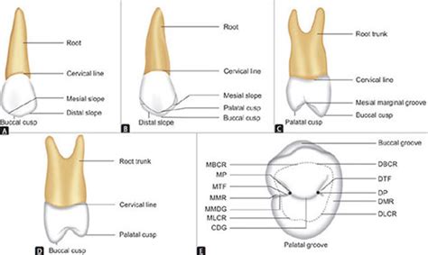 Maxillary First Molar Oblique Ridge