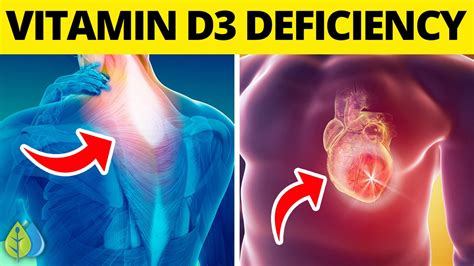 Top 14 Signs of Vitamin D3 Deficiency You Need to Know