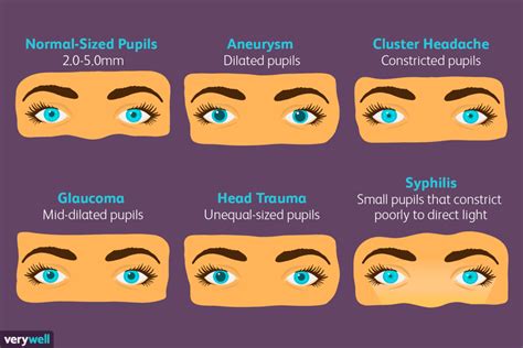 Printable Pupil Size Chart