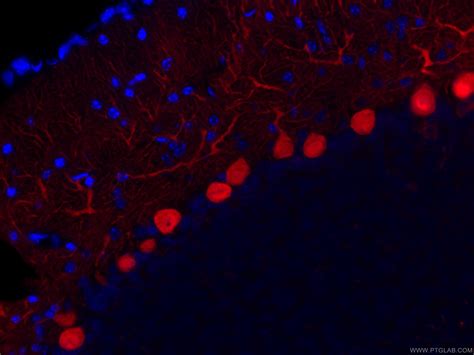 Calbindin-D28k antibody (CL594-66394) | Proteintech | 武汉三鹰生物技术有限公司