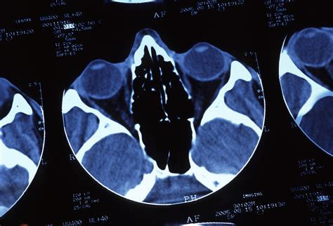 Free Stock image of CT scan | ScienceStockPhotos.com