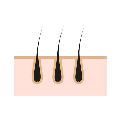 Understand The Side Effects Of Laser Treatment! l Perfect Laser Clinics