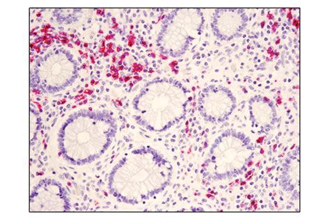 SignalStain® Vibrant Red Alkaline Phosphatase Substrate Kit | Cell ...