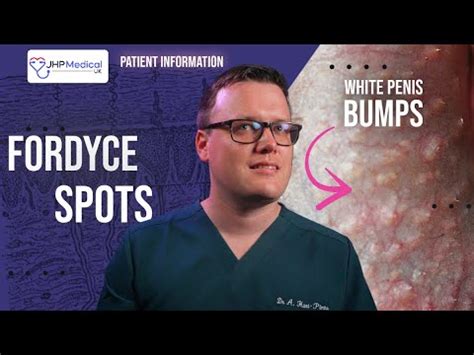 Fordyce Spots (Granules) | Yellow or White Lumps on the Penis | Doctor ...