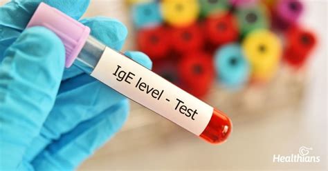 Know whether you are allergic or not with the Total IgE Antibody Test