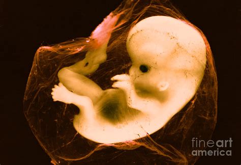 Eight Week Human Fetus Photograph by Biophoto Associates - Fine Art America