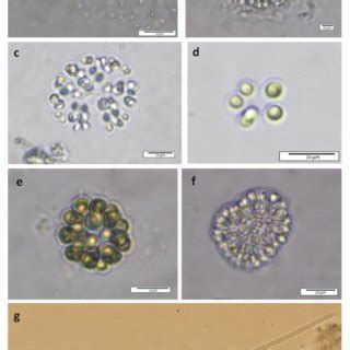 Cyanobacteria; a) Synechocystis parvula, b) Coelosphaerium aerugineum ...