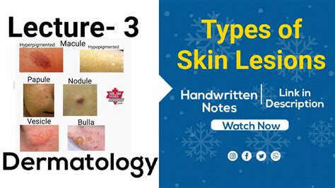 Types of Skin Lesions || Dermatology Lecture -3 || Link for Handwritten Notes is in Description ...