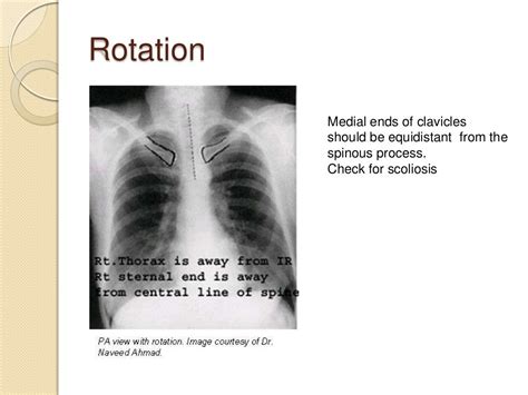 Chest radiography introduction