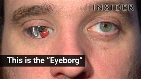 This is the "Eyeborg" - YouTube