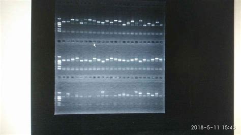 pcr凝胶电泳图读图,pcr扩增电泳条带图读图 - 伤感说说吧