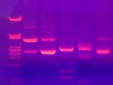 Speeding Up DNA Separation in a Microchannel via Simulation | COMSOL Blog