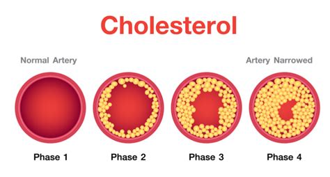 Lipitor (Atorvastatin) - Lipitor - PocketDrugGuide