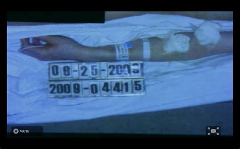 NEW Michael Jackson Autopsy Photo