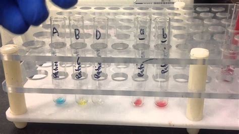 ️ Blood group test procedure. Principle Blood Group test ..... cupsoguepictures.coment type ...