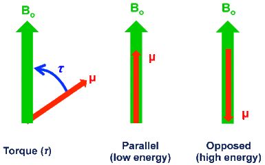 Magnetic dipole moment - Questions and Answers in MRI