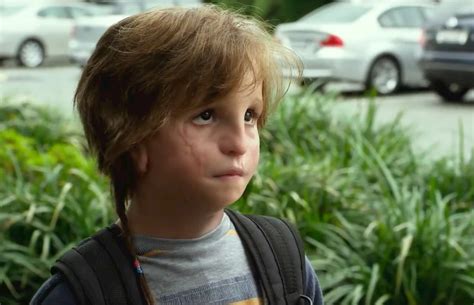 What Condition Does Auggie Have In 'Wonder?' The Heartbreaking Movie Depicts A Child With Facial ...