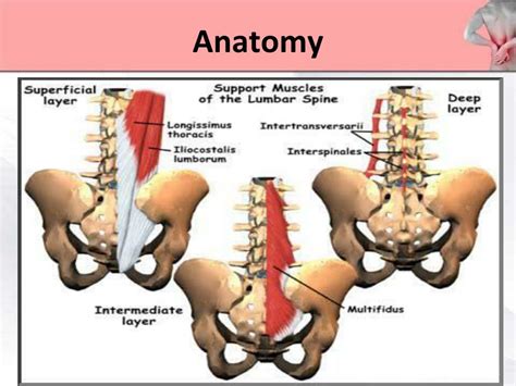 PPT - Lower Back Pain PowerPoint Presentation, free download - ID:2120524