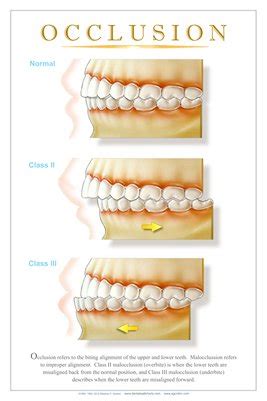 Dental Wall Charts | "OCCLUSION" - (white) Dental Wall Ch… | MagCloud