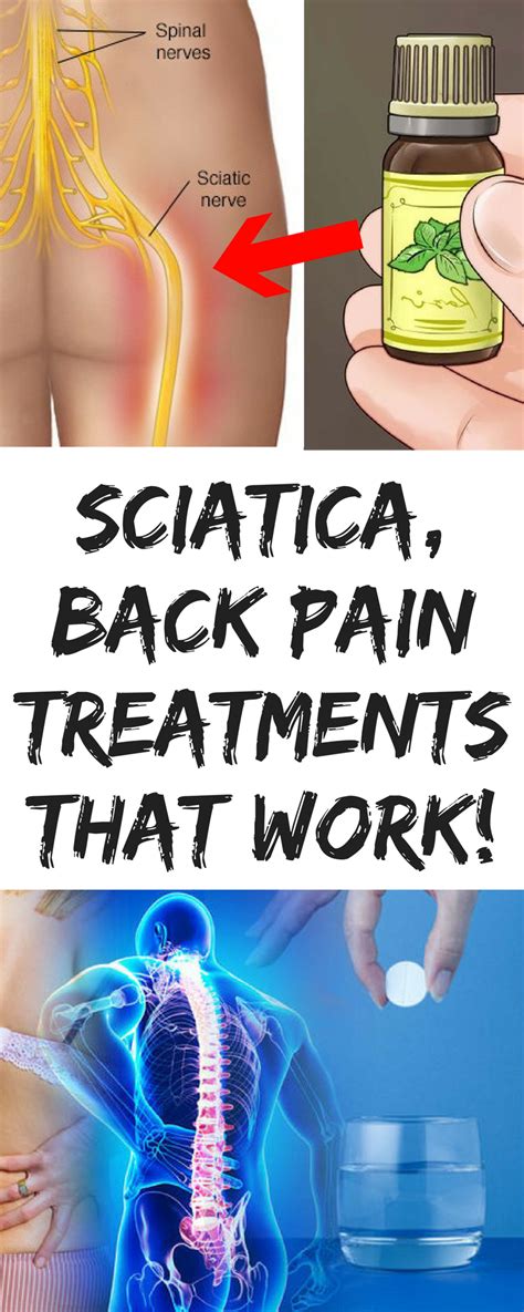 Pin on Sciatica treatment