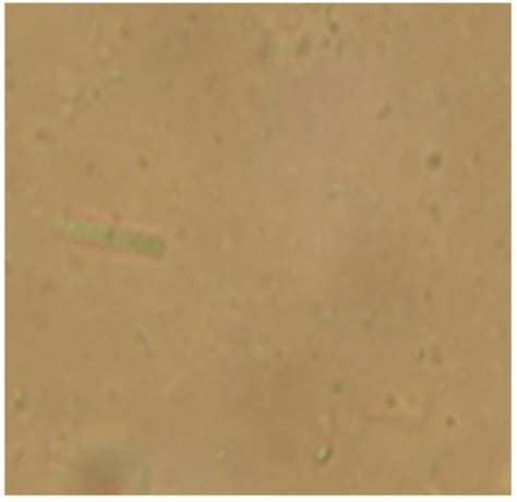 B. Actinomyces naeslundii API 20A: The organism is a small, gram ...