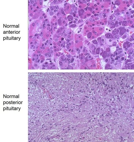 Anterior Pituitary Histology