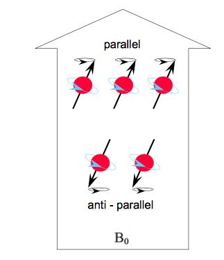 Magnetization - MRI : Magnetic Resonance Imaging