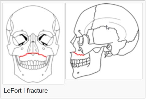 IL - IL - Chicago, Male, RaceUnk, 40-60, UP12209. Lake Michigan, extensive surgery on the face ...