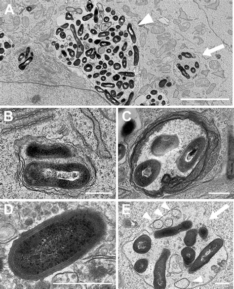 Electron microscopic images of intracellular P. acnes. HeLa cells ...