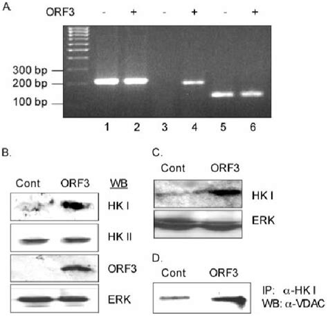 Hexokinase expression and its interaction with VDAC | Download ...