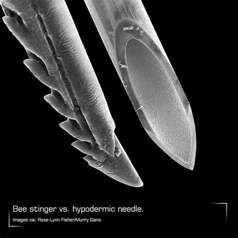 Pin on JuNk Drawer | Things under a microscope, Hypodermic needle, Stinger