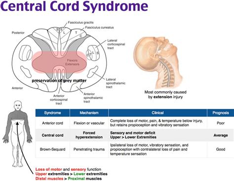 njury to the central cord commonly occurs after a fall or motor vehicle collision where there is ...