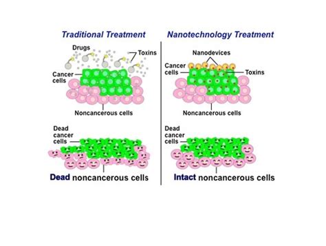 Nanotechnology importance in discovering & treatment of cancer disease | Science online