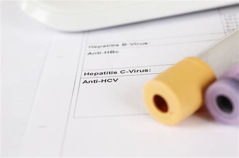 Laboratory test, Hepatitis C, blood tubes on paper | Recovery SI