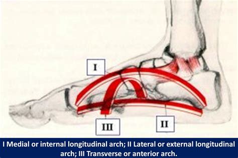 Anatomy, Bony Pelvis and Lower Limb: Medial Longitudinal Arch of the Foot | Treatment ...