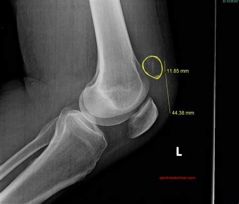 CASE 7 – LAGGING BEHIND | Sport Med School