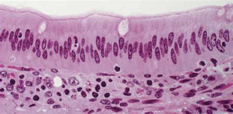 Simple Columnar Epithelium Diagram | Quizlet