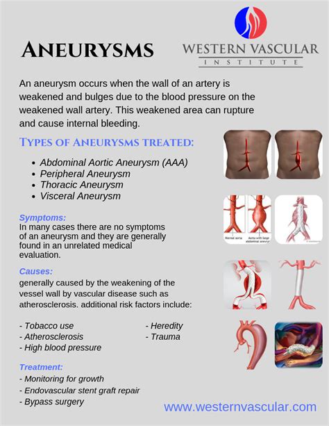 Aneurysms | Vascular surgery, Medical knowledge, Medical school essentials