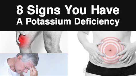 8 Signs You Have A Potassium Deficiency | Potassium deficiency, Potassium deficiency symptoms ...