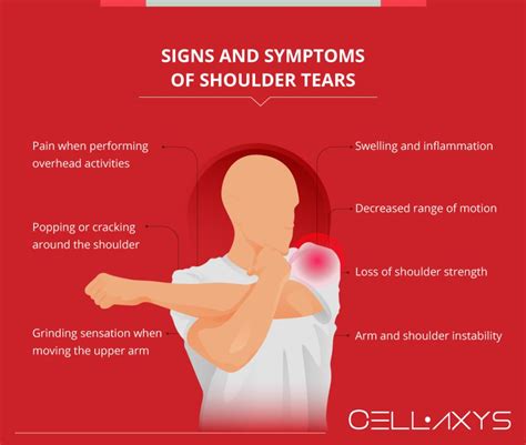 Shoulder Labrum Tears: Treatment And Diagnosis - Cellaxys