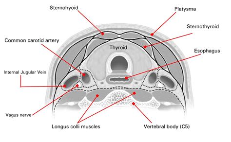 Normal Thyroid Ultrasound Colors