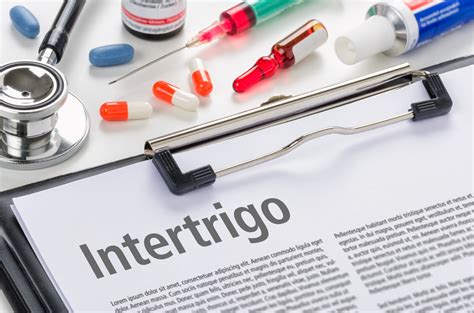 10 Treatments for Intertrigo - Facty Health