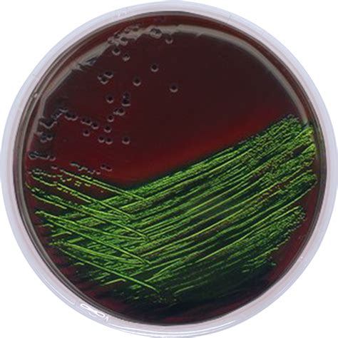 EOSIN METHYLENE BLUE AGAR | Agarindo Biological Company