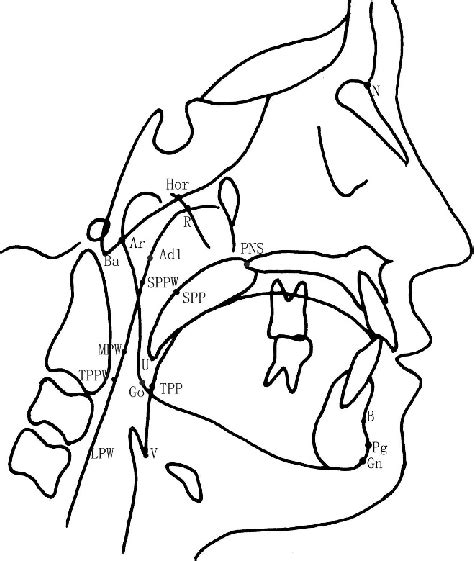 Cephalometric landmarks. | Download Scientific Diagram