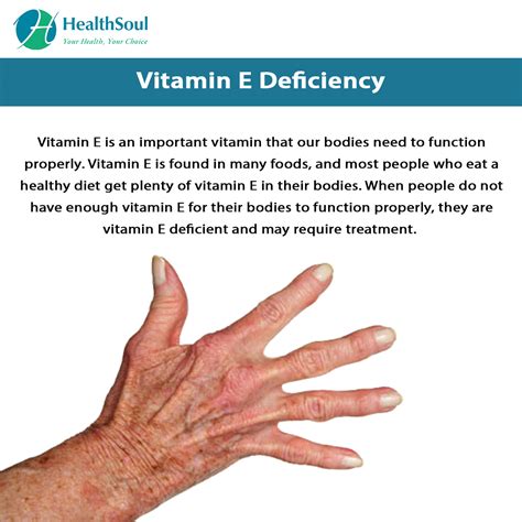 Vitamin E Deficiency – Healthsoul