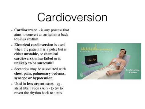 Defibrillation and cardioversion